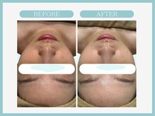 スリムライン 青森店(The Slim Line)/before→after