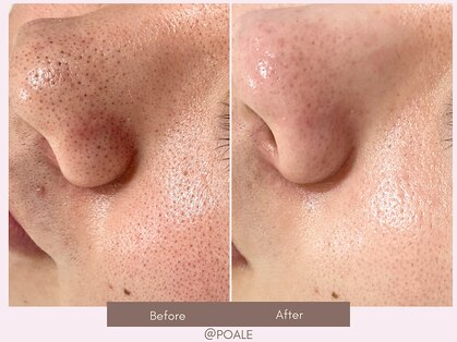 ポアレ 熊谷店(POALE)の写真