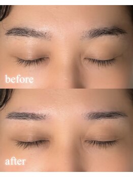 リノア(Linoa)/メンズ眉毛デザイン脱毛