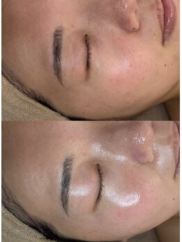 ルミエ(Lumie)の写真/フェイシャルWAXと水分導入トリートメントで艶美肌に導きます◎