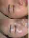 ルミエ(Lumie)の写真/フェイシャルWAXと水分導入トリートメントで艶美肌に導きます◎