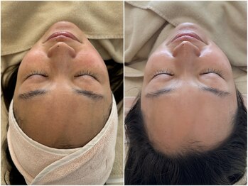 マヴィ 香里園店(MavY.)/透け肌へ!水光肌に!!