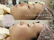 ラミーユ(La Miu)/マスク荒れや蒸れにもWAX