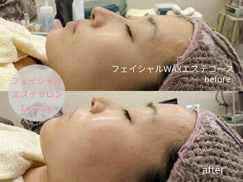 ラミーユ(La Miu)/マスク荒れや蒸れにもWAX