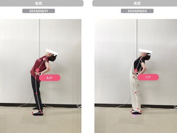 ナオル整体 国分寺院(NAORU整体)/40代女性【AI分析　後屈】