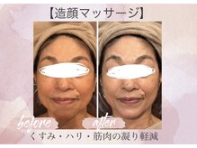 オキシー グレイス 小倉店(OXY Grace)/60代お客様ビフォーアフター