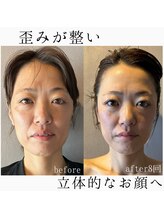 語 かたりべ/【エステ】ビフォー・アフター