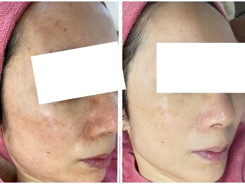 メアリーウィズ(Mary with)