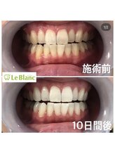 ルブラン 奈良店(Le Blanc)/就職活動に向けて