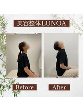 美容整体LUNOA　神戸三宮院/[三ノ宮/美容整体/整体/肩こり]