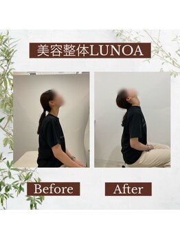 美容整体LUNOA　神戸三宮院/[三ノ宮/美容整体/整体/肩こり]