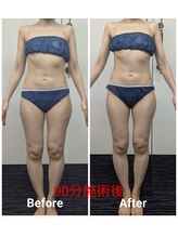 フィニシオン/40代90分施術　立ち仕事浮腫歪み