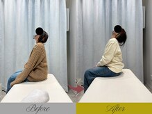 リン 大宮院(RIN)/Before/After