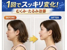 ドクターアーチ 神戸三宮 小顔矯正･整体サロン(Dr.ARCH)/1回で変化を実感できる！