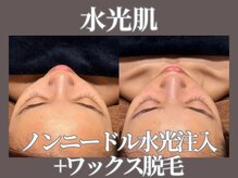 マヴィ 今福鶴見店(MavY.)/水光注入×ワックス脱毛