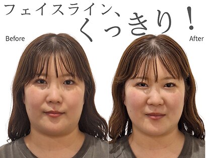 レジスタ(REGISTA)の写真