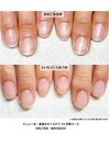 最強のネイルケア３ケ月間コース