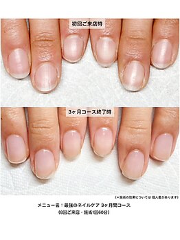 ネイルサロン ラピエトラ(la pietra)/最強のネイルケア3ケ月間コース