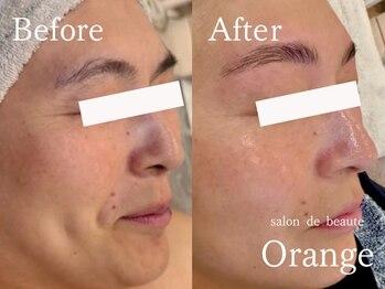 サロンドボーテ オランジュ(salon de beaute Orange)/タラソトリートメント