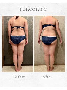 ランコント(rencontre)/肩こり/リンパ/ヘッドスパ/痩身