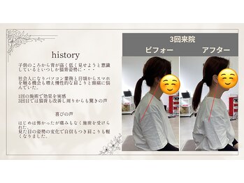 ユウシン 佐土原院(U-SHIN)/猫背 肩こり 頭痛