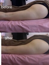 イーリバイブ/iNVYDOM MAX