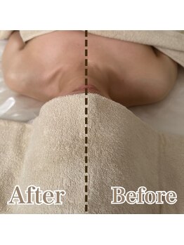 オン 絹(on silk)/深層筋膜リンパ90分1回