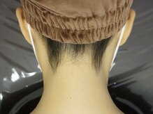 フラット(FLAT)/都度払いで豊富な脱毛メニュー