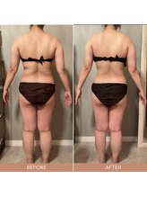 リファラ 光の森店(REFALA)/【痩身/20代女性】約3ヶ月の結果