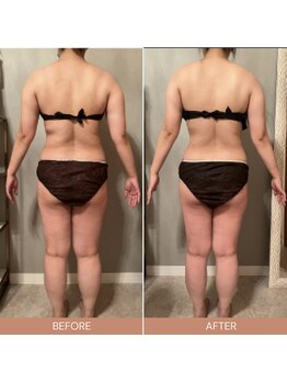 リファラ 光の森店(REFALA)/【痩身/20代女性】約3ヶ月の結果