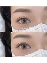 アミーラ(Amira)/サンフラワーデザイン