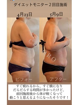 エイジングレスサロン ココロ 八女店(COCORO)/ダイエットモニター