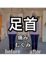 カワル整体 上通り院/足首の痛み・むくみ