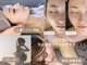 ベルミア(Bellemia)の写真