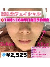 ハニーアイズ(Honey Eyes)/当日予約限定BBLフェイシャル