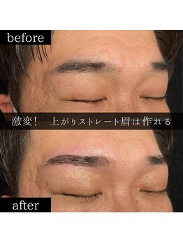 ユー 千葉駅前店(you)/ビフォーアフター写真