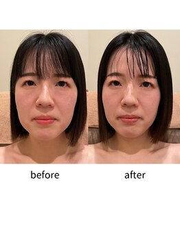 シエル(Ciel)/見た目の変化も効果絶大