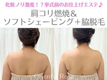 オリエンタルローザ 表参道(Oriental Rosa)/肩コリ燃焼×ソフトシェービング