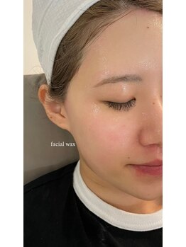 ウル(ulu)の写真/メイクノリupフェイシャルワックス★ニキビにも効果◎＜顔脱毛/フェイスワックス￥9900~＞眉毛セットも◎