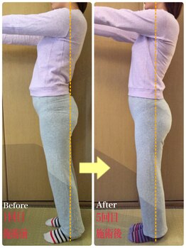 美容整体専門院 新美選/スタイルアップ整体 変化写真