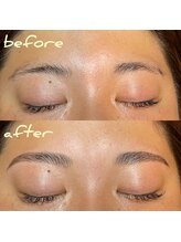 ミーティット(Meetite)/ハリウッドブロウリフト