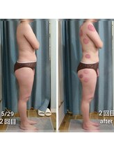 アクア(AQUA)/デトックスコース