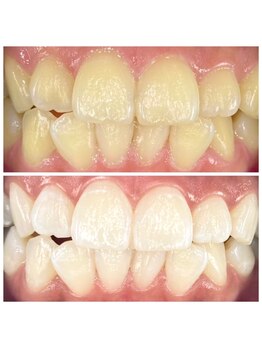 エンムスビ(enmusubi)/