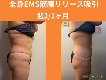 ボディエイジングラボ マハロ(MAHALO)/★ブライダル★自分史上最幸の姿