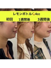 ララチッタ(L'la citta)/レモンボトル4cc