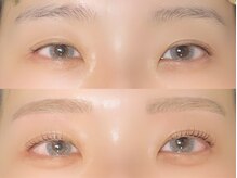 リモア(remoa)/【青山指名】垢抜け3点セット★