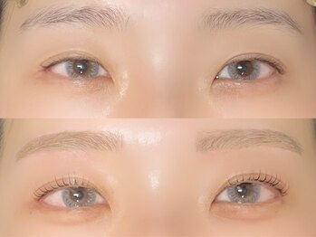 リモア(remoa)/【青山指名】垢抜け3点セット★