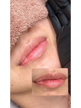 オンユ(ON’U)/気になるくすみを撃退!