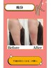 ★痩身★【”ここだけ痩せたい“が叶う】太ももor二の腕orお尻　痩身¥7,150
