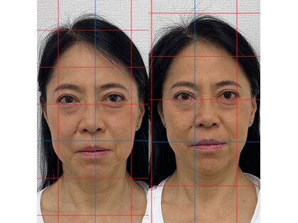 ハーモニーフィットネス 赤坂(Harmony Fitness)の写真